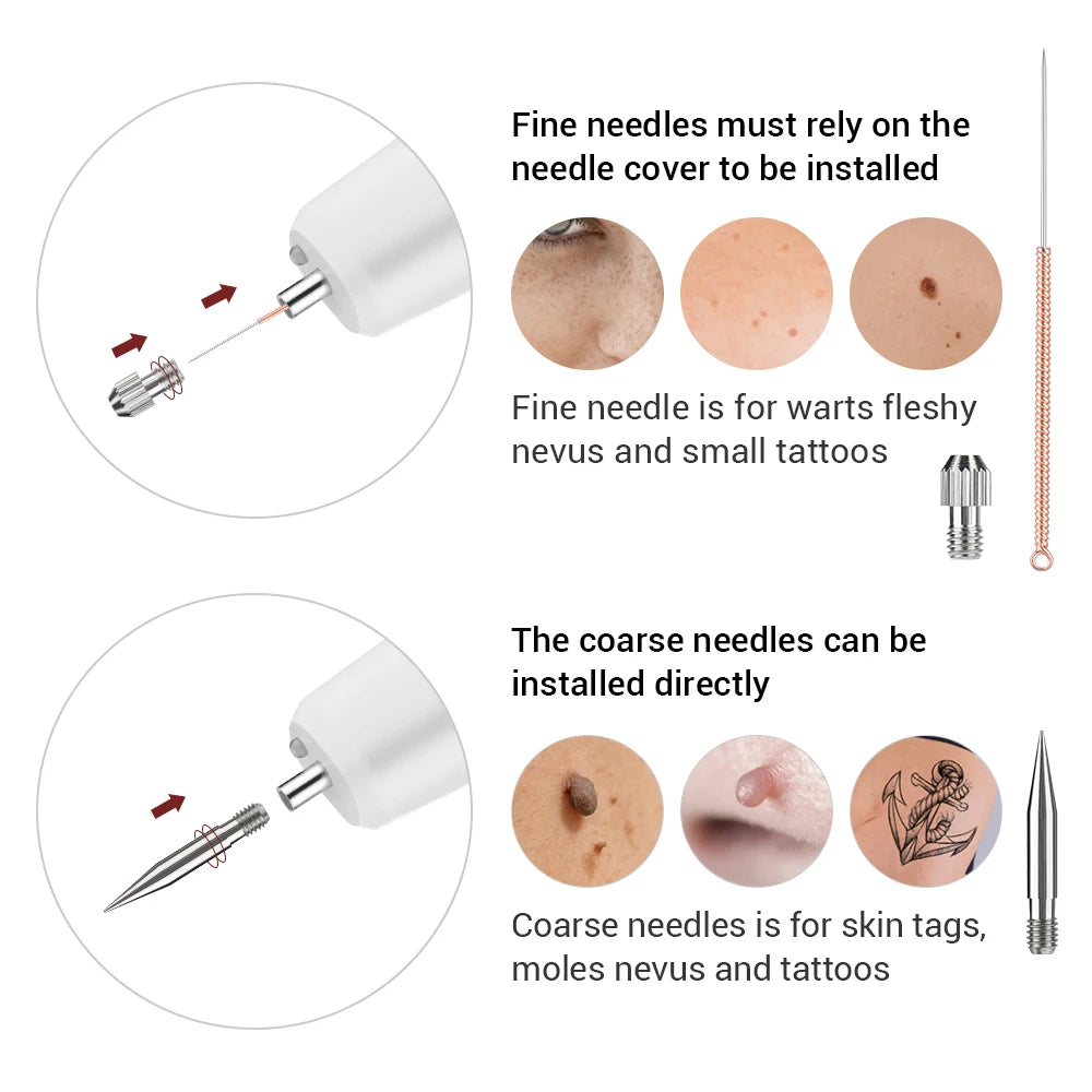 Electric Plasma Pen for Skin Tag, Wart, and Mole Removal