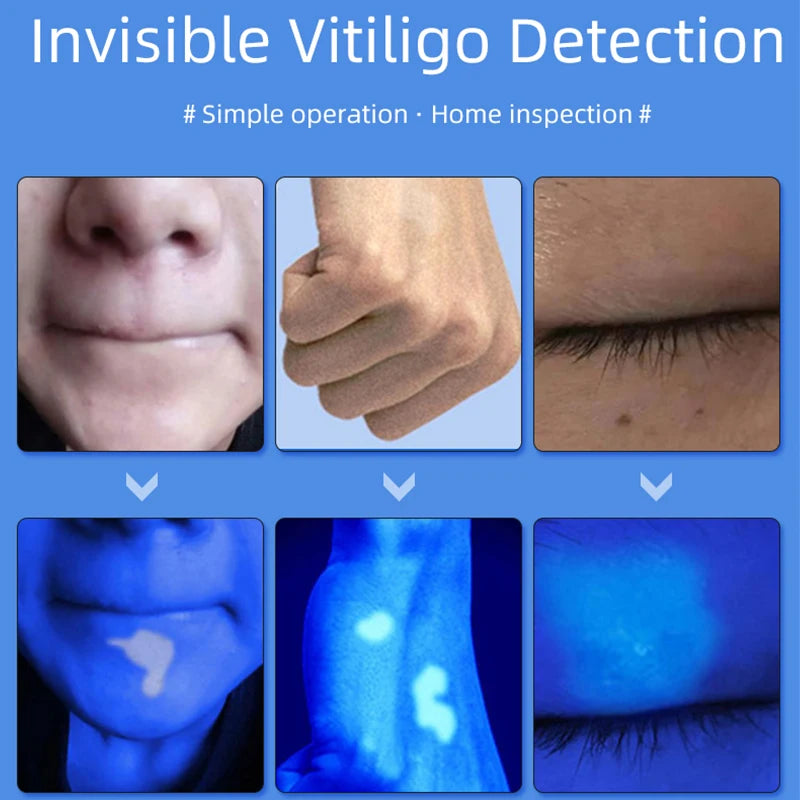 UV Skin Analyzer – Portable Beauty Examination Tool