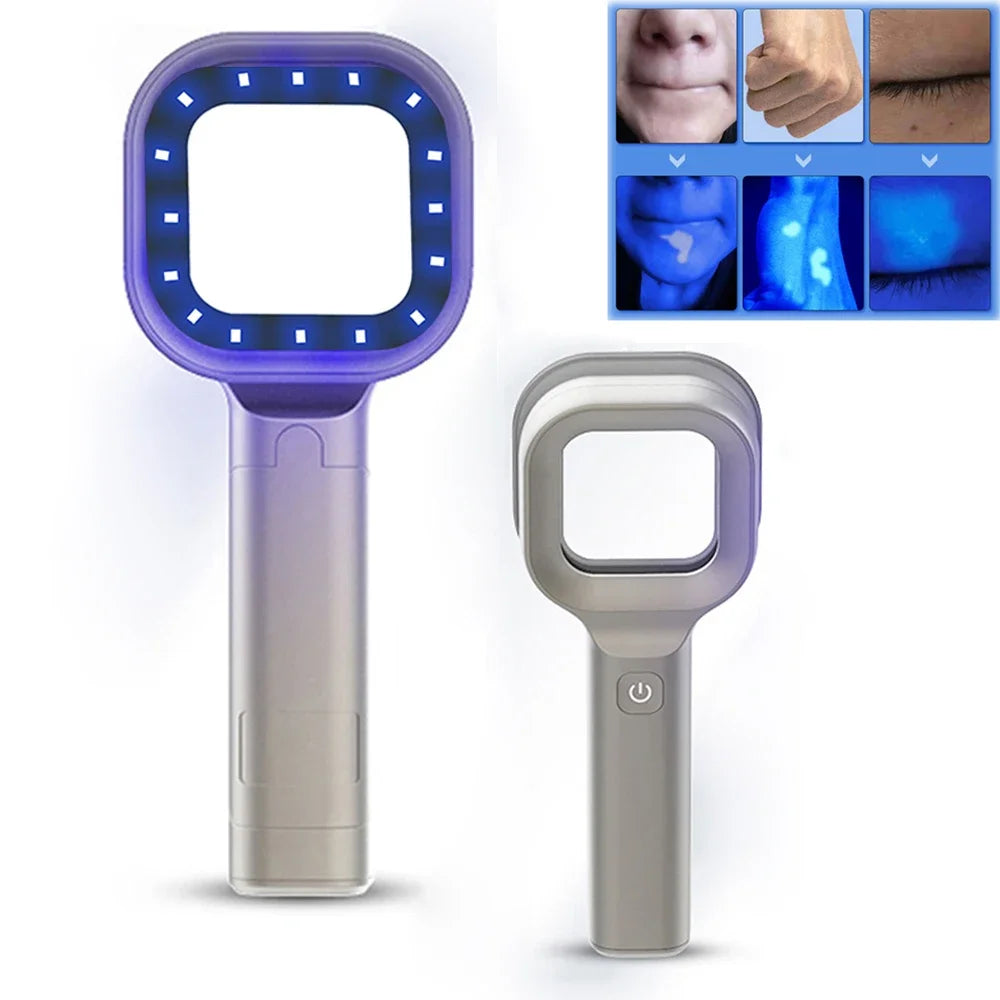 UV Skin Analyzer – Portable Beauty Examination Tool