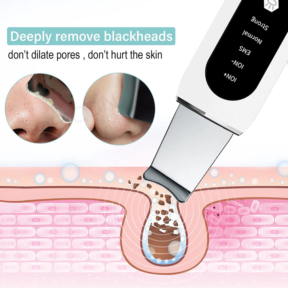 Ultrasonic Skin Scrubber & Blackhead Remover